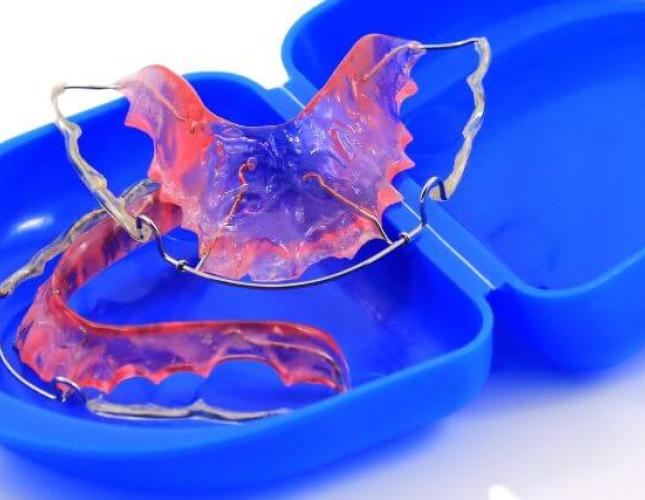 5 Signs It’s Time to Replace Your Retainer